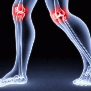 Болить коліно: що робити і до якого лікаря звертатися при болях в коліні