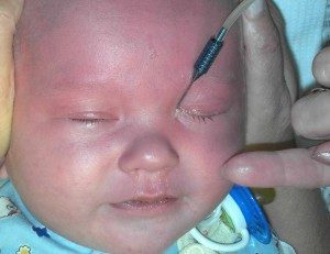 Зондування слізного каналу у новонароджених і дітей до року: відео, наслідки, відгуки, як роблять
