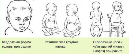 Аналіз сечі по Сулковича: норма і розшифровка у дітей, як зібрати у грудничка
