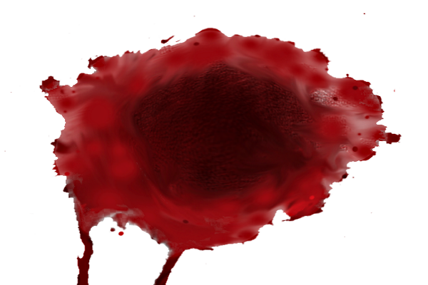 Згустки крові при місячних схожі на печінку: причини, що це таке