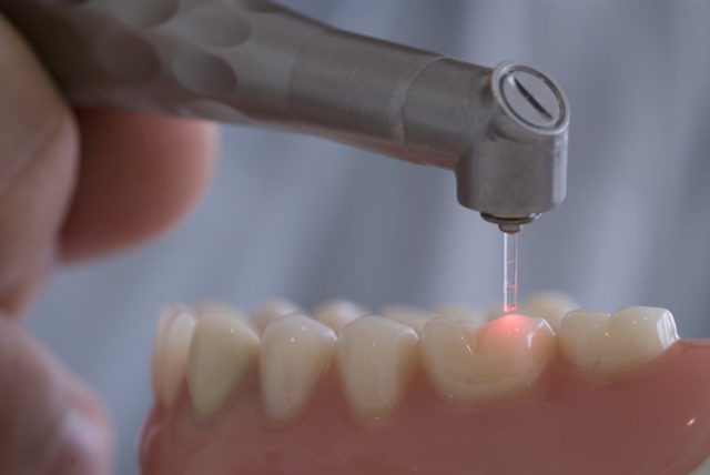 Чому темніють зуби у дорослих: причини потемніння зубної емалі і методи відбілювання зубів