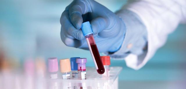 Чому підвищений білок в крові: причини високого показника і норма
