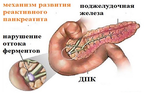 Чому виникають проблеми зі шлунком у грудничка?