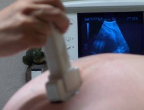 Тонус матки при вагітності: чому виникає в 1, 2 і 3 триместрах і що з цим робити?