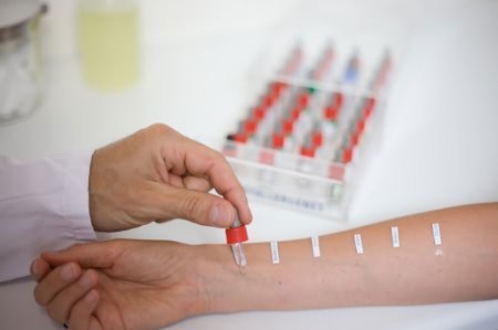 Як розшифрувати результати крові на імунноглобулін Е?
