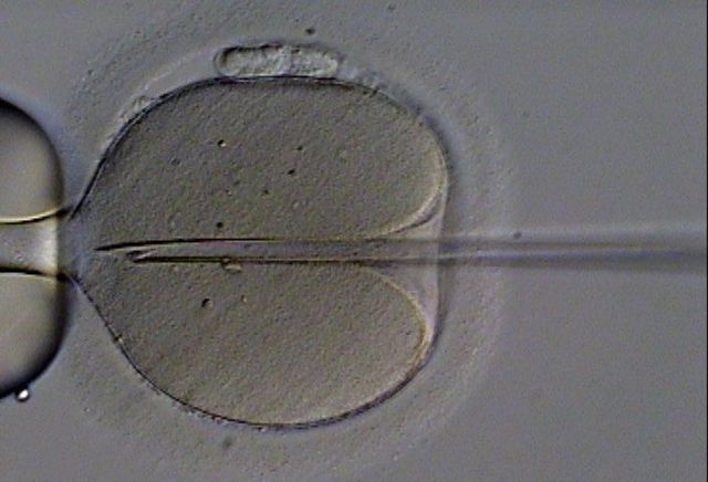 Некроспермія: чи можна вилікувати, чи можна завагітніти