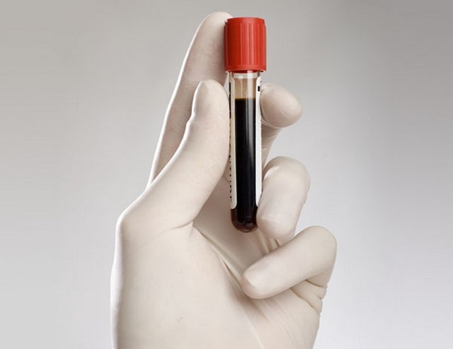 Коагулограма крові: розшифровка, норми, показники коагулограми крові