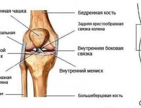Розрив зв'язок колінного суглоба: ступеня тяжкості, діагностика та особливості лікування, реабілітація