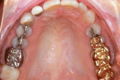 Чи може від зуба боліти горло: чому і що робити?