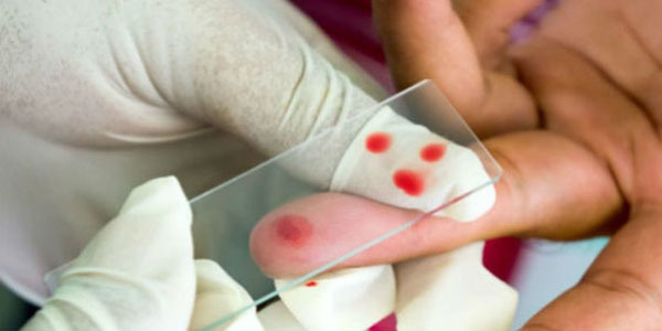 Як беруть кров з вени у новонародженого, немовляти, підготовка до аналізу крові з вени