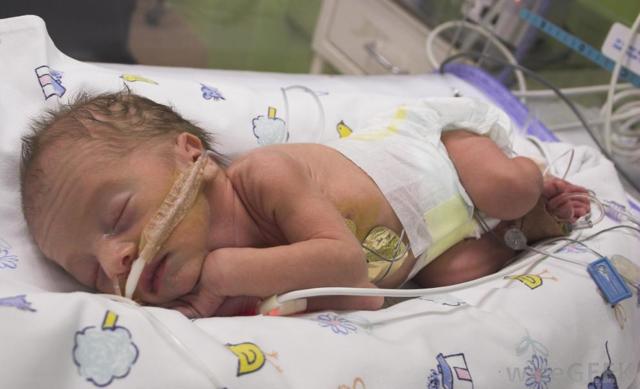 Вроджена пневмонія у новонароджених: причини і наслідки, лікування