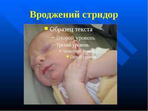 Природжений стридор гортані у новонароджених, немовлят, дітей раннього віку
