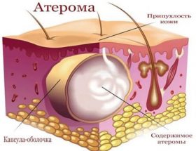 Дерматози: симптоми, причини розвитку, види, медикаментозні методи лікування і народна медицина