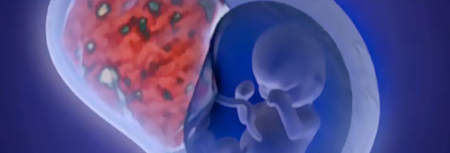 Завмерла вагітність: причини розвитку на ранньому і пізньому терміні, фактори ризику