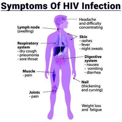 СНІД - симптоми, прояви СНІДу, діагностика, лікування, підтримуюча терапія і прогноз