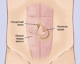 Хворобливе ущільнення в животі у жінок: можливі причини і методи діагностики 