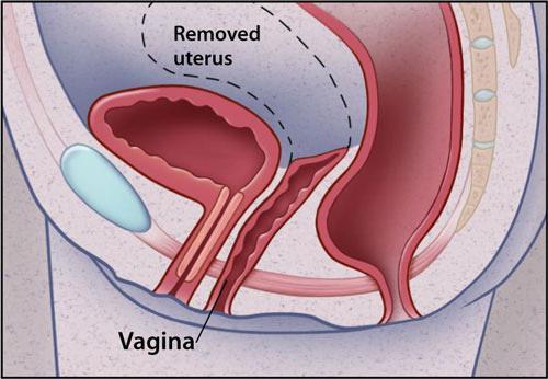 Анатомія матки жінки: докладний опис