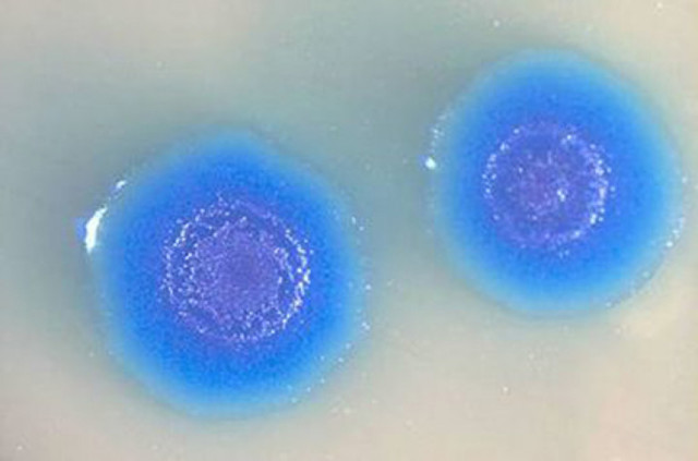 Мікоплазма геніталіум у чоловіків: симптоми і лікування mycoplasma genitalium