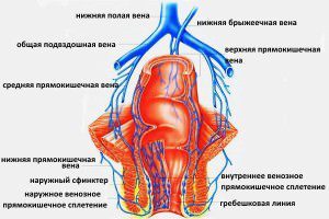 Синдром нижньої порожнистої вени: що це таке?