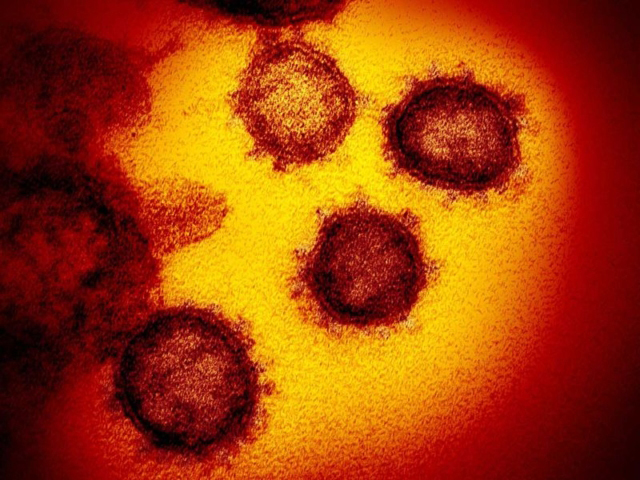 Симптоми коронавируса COVID-19: 13 пунктів, які кожен повинен знати в 2023 році