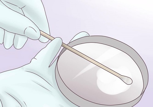 Як визначити, цистит або молочниця, якщо мазок в нормі?