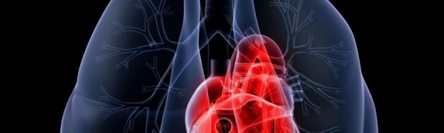 Легеневе серце: діагностика та лікування, скільки з цим живуть