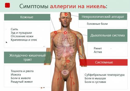 Алергія на метал: залізо, цинк, нікель. Симптоми і лікування
