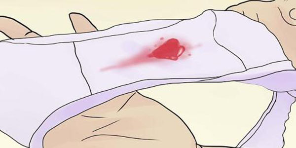 Кровотеча на ранньому терміні вагітності - що робити: перша допомога та лікування кровотеч в першій половині вагітності. 