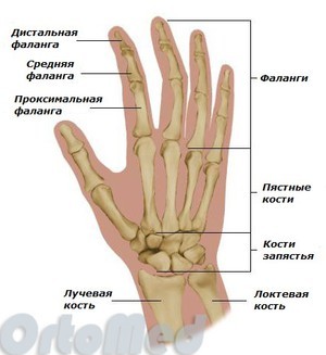 Перелом фаланги пальців кисті руки: симптоми, що робити, скільки носити гіпс