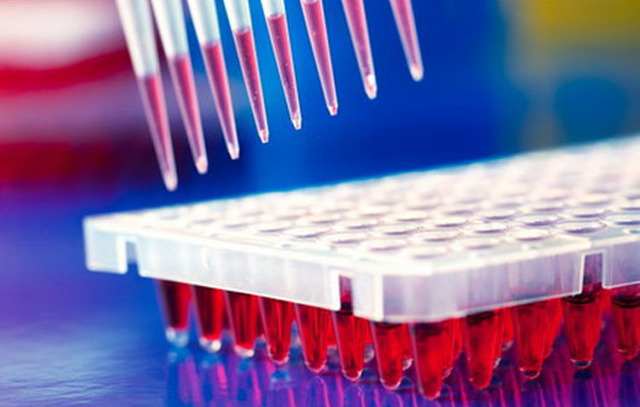 На що вказує сильне підвищення антитіл при аналізі крові ІФА?