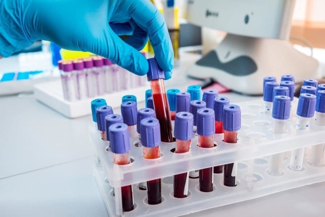 Як розшифрувати дані аналізу крові та імунограми