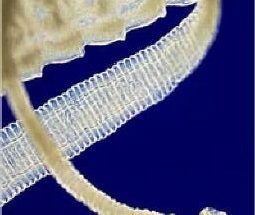 Стрічкові черв'яки у людини: бичачий ціп'як, широкий лентец, свинячий ціп'як, ехінокок