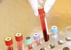 Коагулограма крові: розшифровка, норми, показники коагулограми крові