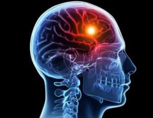 МРТ голови: що показує і як роблять МРТ голови і судин головного мозку