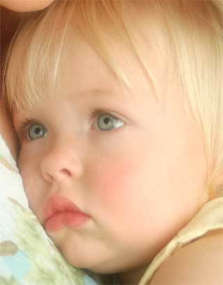 Грибкова ангіна (тонзиліт): симптоми і лікування у дітей та дорослих