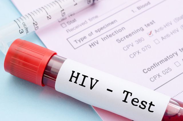 Симптоми ВІЛ у чоловіків: як проявляється ВІЛ у чоловіків, перші ознаки ВІЛ у чоловіків