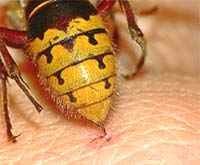 Укуси жалких комах у дітей - оси, бджоли, джмелі, шершні, чим небезпечні, як проявляються, що робити для зменшення свербежу та почервоніння, біль