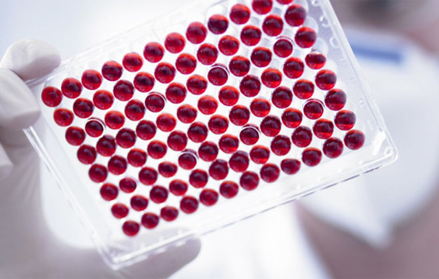 На що вказує сильне підвищення антитіл при аналізі крові ІФА?