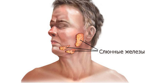 Захворювання слинних залоз: симптоми і лікування