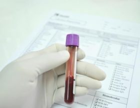 Аналіз крові на еозинофіли дитини: причини призначення, рекомендації по підготовці, розшифровка результатів