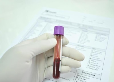 Аналіз крові на еозинофіли дитини: причини призначення, рекомендації по підготовці, розшифровка результатів