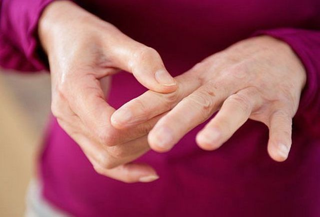 Нарости на суглобах пальців рук (шишки): види, причини, симптоми і лікування