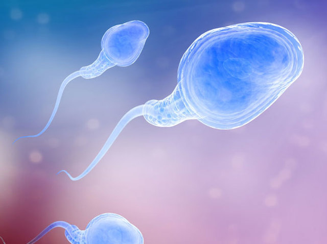 Астенозооспермія - лікування, причини, ймовірність вагітності при астенозооспермії