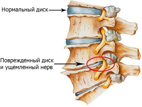 Біль в лівому підребер'ї ззаду: можливі причини, характер болю, можливі методи обстеження і лікування