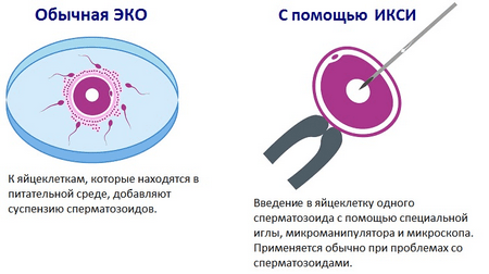 Некроспермія: чи можна вилікувати, чи можна завагітніти