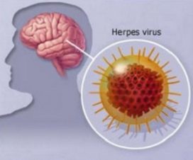 Герпес 7 типу: симптоми і лікування, діагностика вірусу герпесу і профілактика