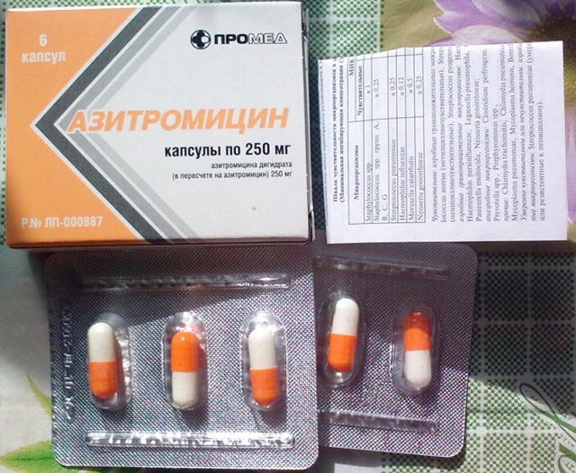 «Зіоміцін»: інструкція із застосування антибіотика, побічні дії і аналоги