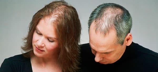 Чому випадає волосся у жінки в молодому віці: головні причини і методи усунення проблеми