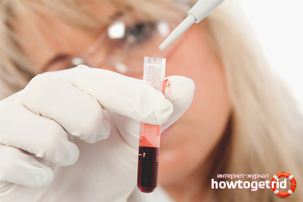 Розрідження крові - показання до проведення, препарати для розрідження крові, розрідження крові народними засобами або за допомогою аспірину.