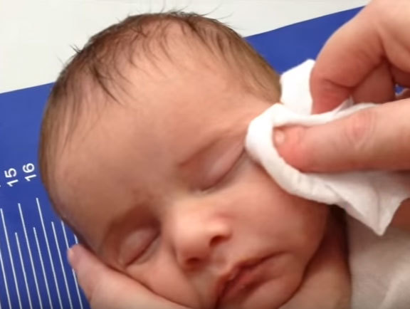 У немовляти гноїться око: що робити, якщо у дитини закисает очей